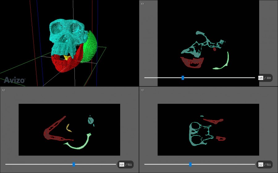 Figure 1: Chimpanzee skull segmentation process using Avizo lite.
