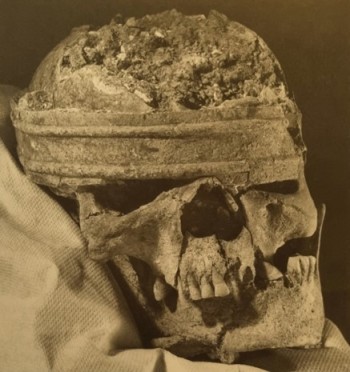 The bronze crown or head-dress found in-situ on the skull of the Mill Hill warrior 