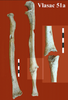 Figure 2: The possible parry fracture from Vlasac, right radius and ulna shown (image: Roksandic 2006).